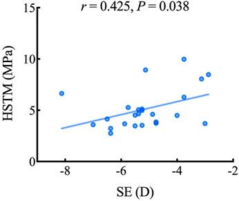 Measuring Human Corneal Stromal Biomechanical Properties Using Tensile Testing Combined With Optical Coherence Tomography